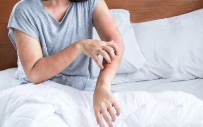 Ik kan niet slapen door jeuk; hoe verminder je nachtelijke jeuk?